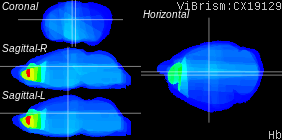 ViBrism