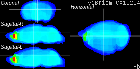 ViBrism