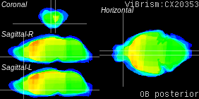 ViBrism