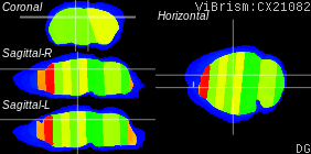 ViBrism