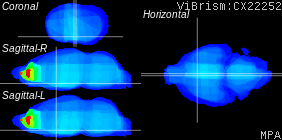 ViBrism