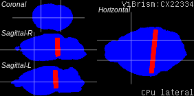 ViBrism