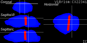 ViBrism