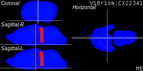 ViBrism