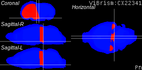 ViBrism
