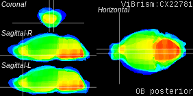 ViBrism