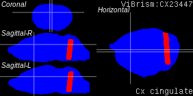 ViBrism