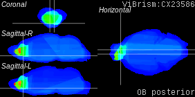 ViBrism