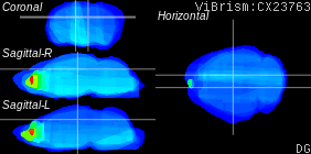 ViBrism