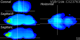 ViBrism