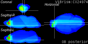ViBrism