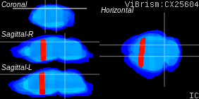 ViBrism