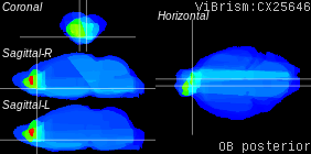 ViBrism