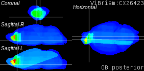 ViBrism