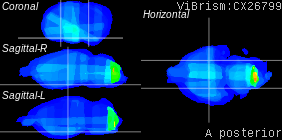 ViBrism