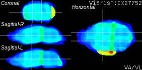 ViBrism