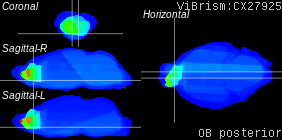 ViBrism