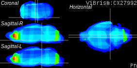 ViBrism