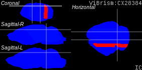 ViBrism