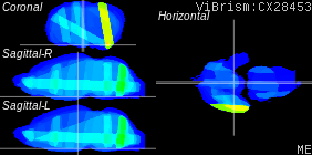 ViBrism