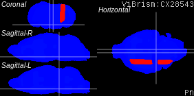 ViBrism