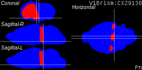 ViBrism