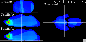 ViBrism