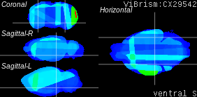ViBrism
