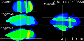 ViBrism