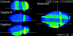 ViBrism