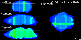 ViBrism