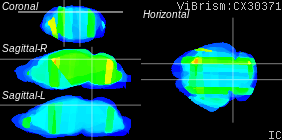ViBrism