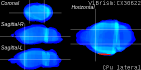 ViBrism