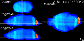 ViBrism