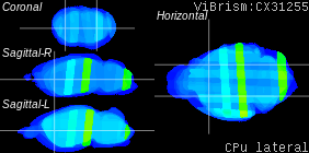 ViBrism