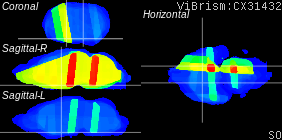 ViBrism