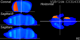 ViBrism
