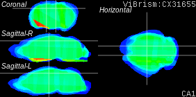 ViBrism