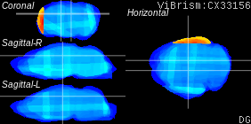 ViBrism