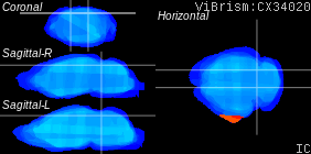 ViBrism