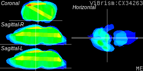 ViBrism