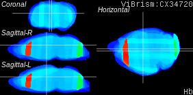 ViBrism