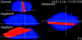 ViBrism