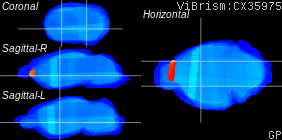 ViBrism