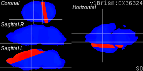 ViBrism