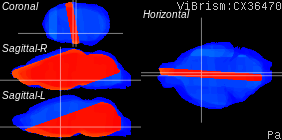 ViBrism